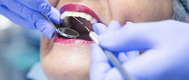 Best Emergency Dental Care for Abscessed Tooth in Fenton, MO